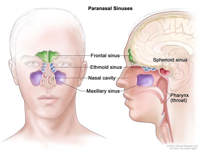 Sinonasal Malignancy (Cancer In the Nose and Sinus Cavity)